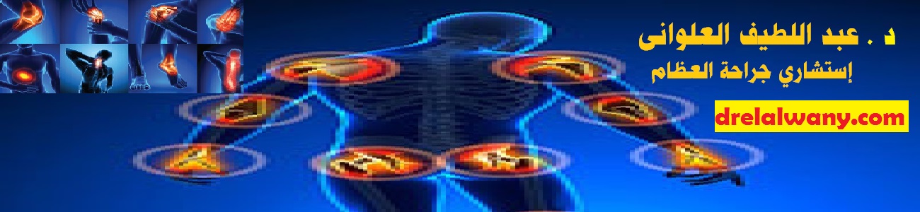 تغيير واستبدال مفاصل