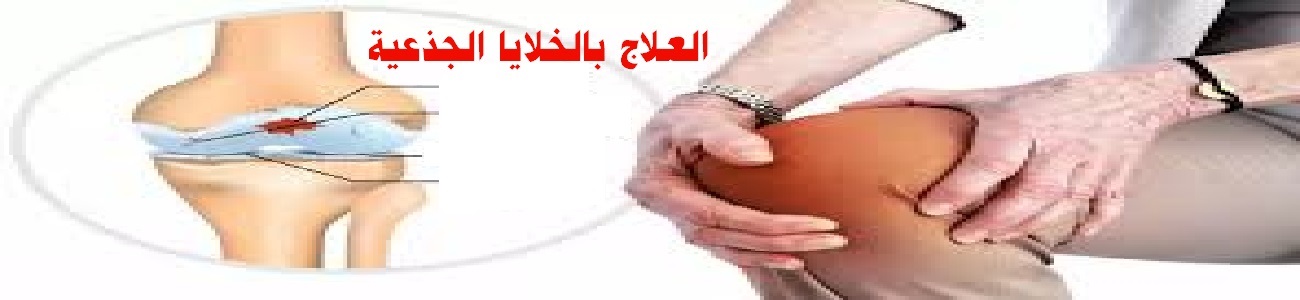 العلاج بالخلايا الجذعية لإصابات العظام والمفاصل